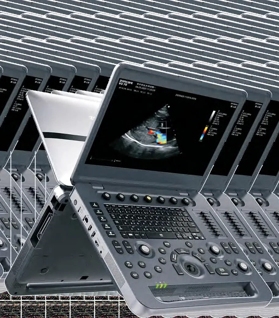 Przenośny aparat USG weterynaryjny Zoncare VU6 z głowicami C13-3M + liniowa L13-3M + phased array P11-3M
