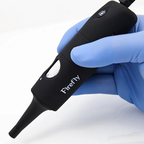 Wideootoskop przewodowy USB Firefly DE501